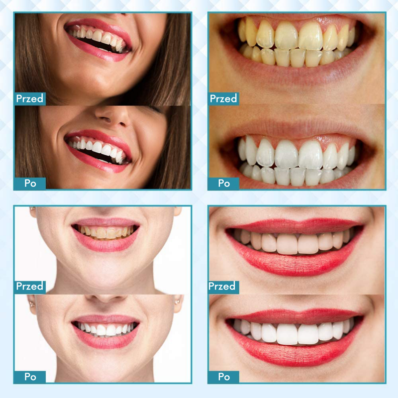 Zestaw Do Wybielania Zebow Lampa Led Dentalforce Higiena Jamy Ustnej Tytul Sklepu Zmienisz W Dziale Moderacja Seo